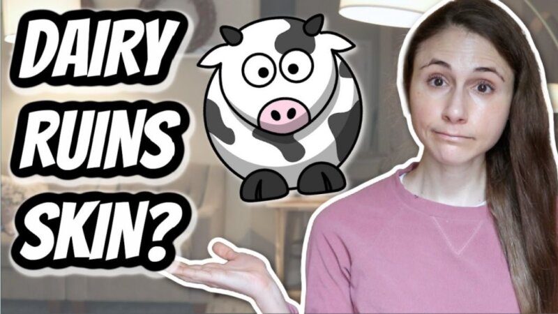does dairy ruin skin & cause acne?| dr dray