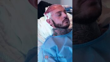 get the best hair transplant in turkey - discover clinic center! #hairtransplantintriguedeclared